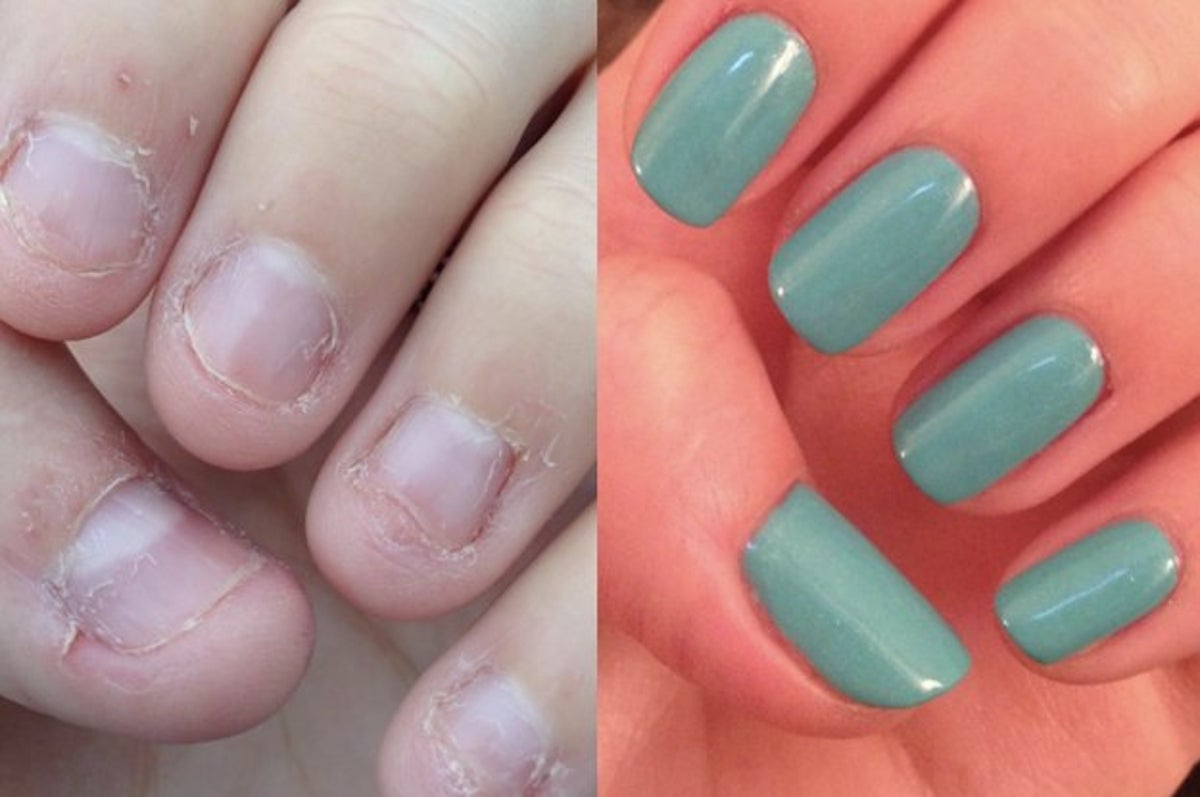 Does Nail Strengthener Work: Investigating the Effectiveness of Nail Strengthening Products