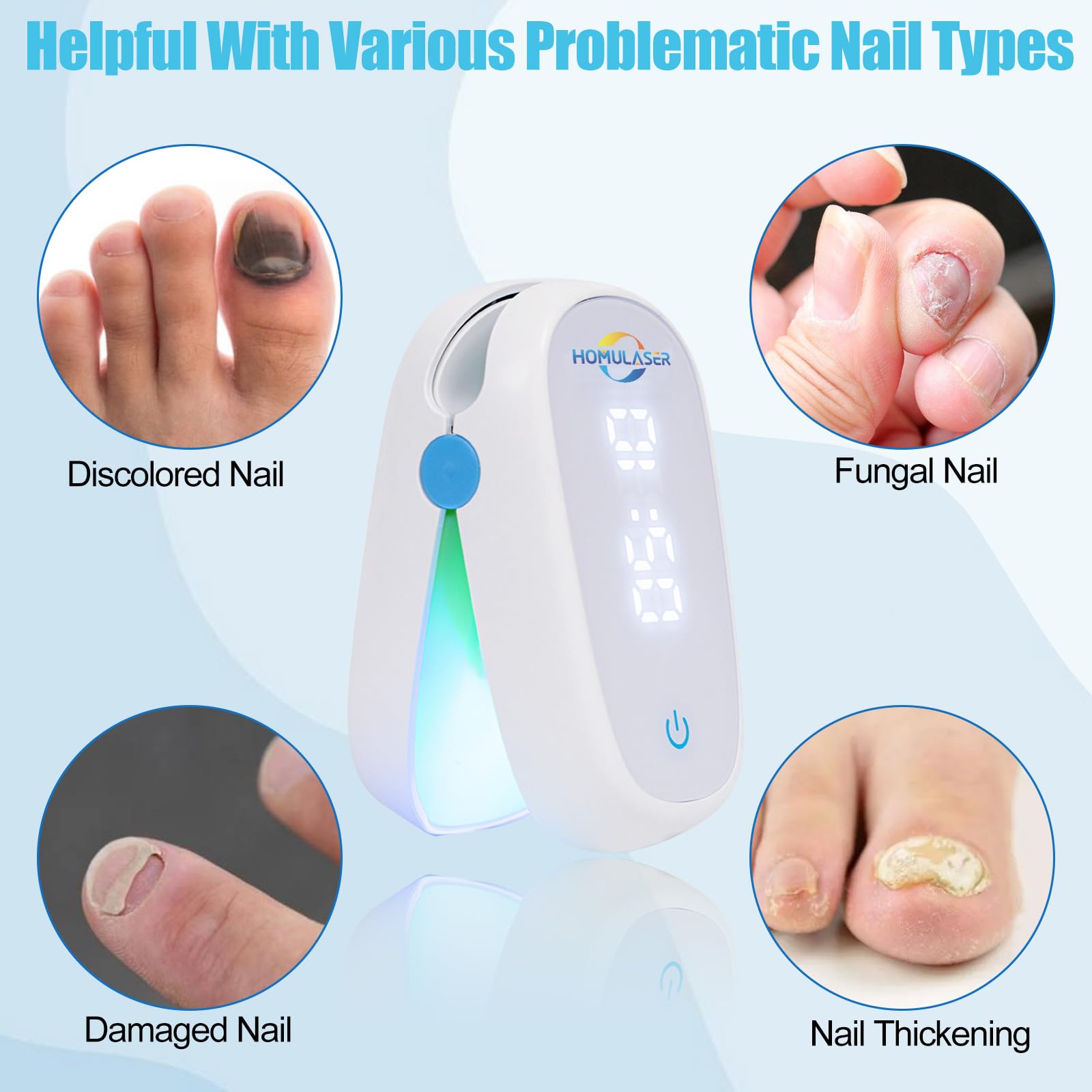 Do Home Nail Fungus Lasers Work: Exploring At-Home Treatments for Nail Fungus